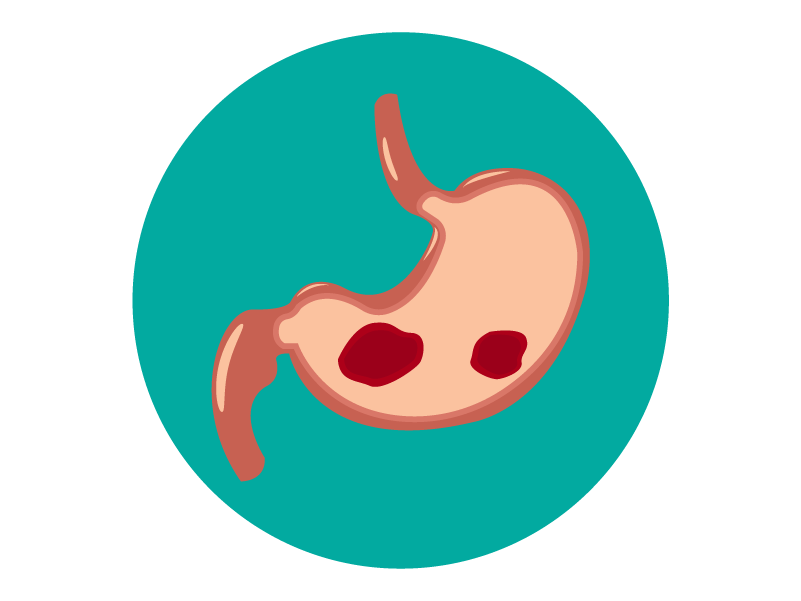 Hemorragia digestiva