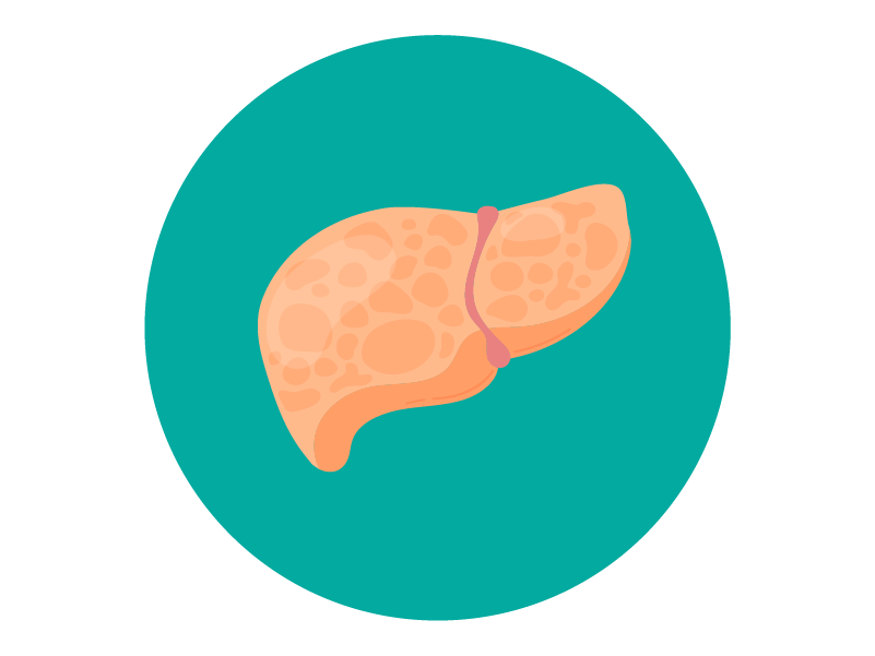 Hígado graso