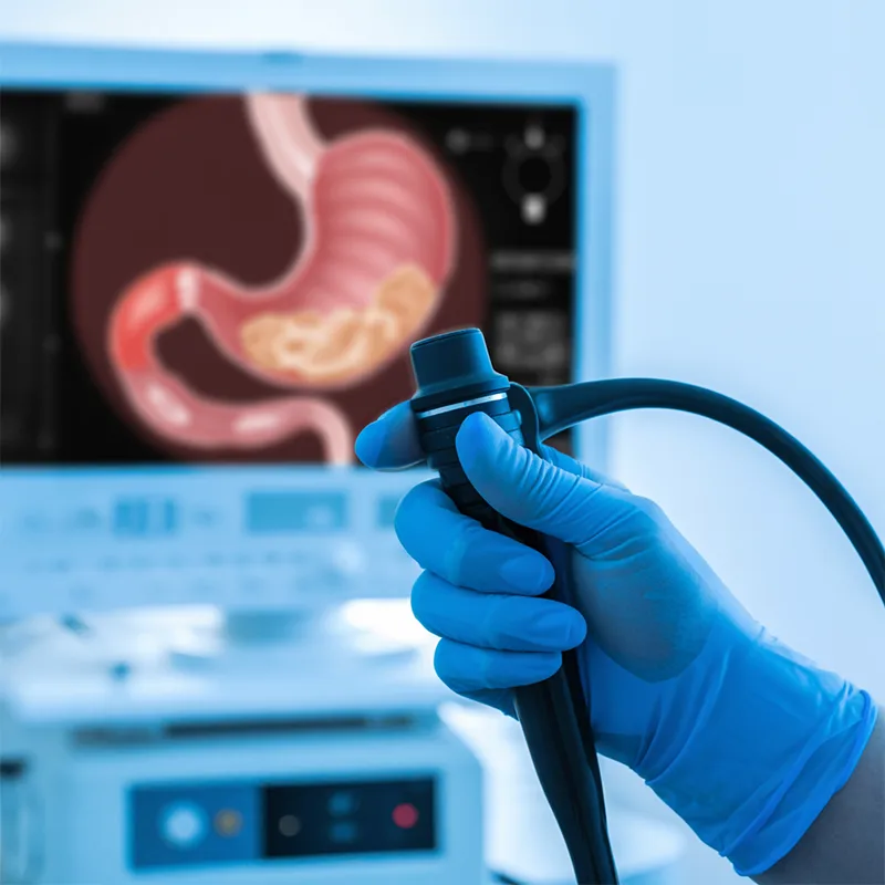 Endoscopía digestiva